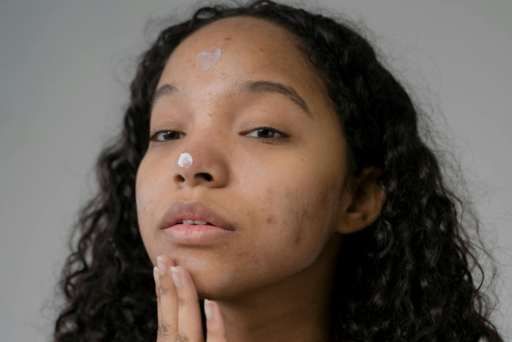 Qual o melhor creme clareador de manchas no rosto